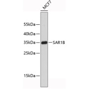 Western blot analysis of lysates from MCF-7 cells, using SAR1B Antibody. Secondary antibody: HRP-conjugated Goat anti-Rabbit IgG (H+L) at 1/10000 dilution. Lysates/proteins: 25 µg per lane. Blocking buffer: 3% nonfat dry milk in TBST.