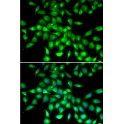 Protein Z Dependent Protease Inhibitor (SERPINA10) Antibody