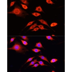 Protein Z Dependent Protease Inhibitor (SERPINA10) Antibody