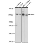 Western blot analysis of various lysates using CRBN Antibody at 1/1000 dilution. Secondary antibody: HRP-conjugated Goat anti-Rabbit IgG (H+L) at 1/10000 dilution. Lysates/proteins: 25 µg per lane. Blocking buffer: 3% nonfat dry milk in TBST. Exposure time: 5s.
