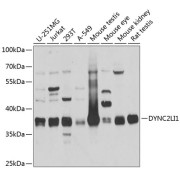 Western blot analysis of various lysates using DYNC2LI1 Antibody at 1/1000 dilution. Secondary antibody: HRP-conjugated Goat anti-Rabbit IgG (H+L) at 1/10000 dilution. Lysates/proteins: 25 µg per lane. Blocking buffer: 3% nonfat dry milk in TBST. Exposure time: 5s.