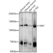 Western blot analysis of various lysates using at 1/1000 dilution. Secondary antibody: HRP-conjugated Goat anti-Rabbit IgG (H+L) at 1/10000 dilution. Lysates/proteins: 25 µg per lane. Blocking buffer: 3% nonfat dry milk in TBST. Exposure time: 180s.