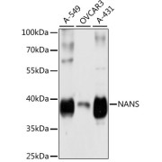 Western blot analysis of various lysates using NANS Antibody at 1/3000 dilution. Secondary antibody: HRP-conjugated Goat anti-Rabbit IgG (H+L) at 1/10000 dilution. Lysates/proteins: 25 µg per lane. Blocking buffer: 3% nonfat dry milk in TBST. Exposure time: 5s.