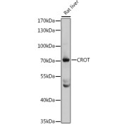 Western blot analysis of lysates from rat liver, using CROT Antibody at 1/3000 dilution. Secondary antibody: HRP-conjugated Goat anti-Rabbit IgG (H+L) at 1/10000 dilution. Lysates/proteins: 25 µg per lane. Blocking buffer: 3% nonfat dry milk in TBST. Exposure time: 5s.