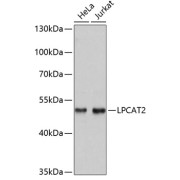 abx003638
