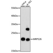Western blot analysis of various lysates using MRPS26 Antibody at 1/3000 dilution. Secondary antibody: HRP-conjugated Goat anti-Rabbit IgG (H+L) at 1/10000 dilution. Lysates/proteins: 25 µg per lane. Blocking buffer: 3% nonfat dry milk in TBST. Exposure time: 90s.