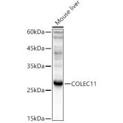 Western blot analysis of lysates from Mouse liver, using COLEC11 Antibody at 1/1000 dilution. Secondary antibody: HRP-conjugated Goat anti-Rabbit IgG (H+L) at 1/10000 dilution. Lysates/proteins: 25 µg per lane. Blocking buffer: 3% nonfat dry milk in TBST. Exposure time: 10s.