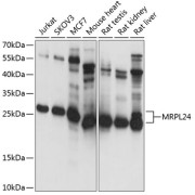 Western blot analysis of various lysates using MRPL24 Antibody at 1/1000 dilution. Secondary antibody: HRP-conjugated Goat anti-Rabbit IgG (H+L) at 1/10000 dilution. Lysates/proteins: 25 µg per lane. Blocking buffer: 3% nonfat dry milk in TBST. Exposure time: 1s.