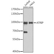 Western blot analysis of various lysates using ATRIP Antibody at 1/1000 dilution. Secondary antibody: HRP-conjugated Goat anti-Rabbit IgG (H+L) at 1/10000 dilution. Lysates/proteins: 25 µg per lane. Blocking buffer: 3% nonfat dry milk in TBST. Exposure time: 30s.