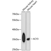 Western blot analysis of various lysates using ACY3 Antibody at 1/3000 dilution. Secondary antibody: HRP-conjugated Goat anti-Rabbit IgG (H+L) at 1/10000 dilution. Lysates/proteins: 25 µg per lane. Blocking buffer: 3% nonfat dry milk in TBST. Exposure time: 90s.