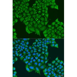 ATPase Inhibitor, Mitochondrial (ATPIF1) Antibody