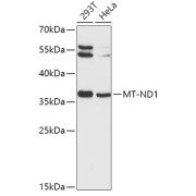 Western blot analysis of various lysates using MT-ND1 Antibody at 1/1000 dilution. Secondary antibody: HRP-conjugated Goat anti-Rabbit IgG (H+L) at 1/10000 dilution. Lysates/proteins: 25 µg per lane. Blocking buffer: 3% nonfat dry milk in TBST. Exposure time: 5s.