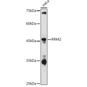 Western blot analysis of lysates from HeLa cells, using RRM2 Antibody at 1/1000 dilution. Secondary antibody: HRP-conjugated Goat anti-Rabbit IgG (H+L) at 1/10000 dilution. Lysates/proteins: 25 µg per lane. Blocking buffer: 3% nonfat dry milk in TBST. Exposure time: 180s.