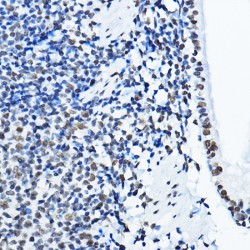 Non POU Domain Containing Octamer Binding Protein (NONO) Antibody