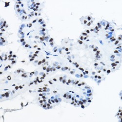 Non POU Domain Containing Octamer Binding Protein (NONO) Antibody