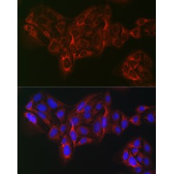 Eukaryotic Translation Initiation Factor 4A1 (EIF4A1) Antibody