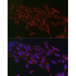 Eukaryotic Translation Initiation Factor 4A1 (EIF4A1) Antibody