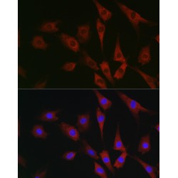 Eukaryotic Translation Initiation Factor 4A1 (EIF4A1) Antibody