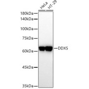 Western blot analysis of various lysates using DDX5 Antibody at 1/1000 dilution. Secondary antibody: HRP-conjugated Goat anti-Rabbit IgG (H+L) at 1/10000 dilution. Lysates/proteins: 25 µg per lane. Blocking buffer: 3% nonfat dry milk in TBST. Exposure time: 60s.