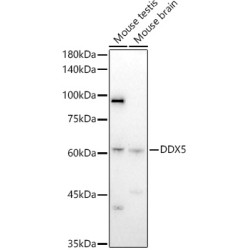 DEAD Box Polypeptide 5 (DDX5) Antibody