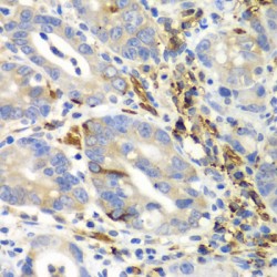 Aminoacyl tRNA Synthetase Complex Interacting Multifunctional Protein 1 (AIMP1) Antibody