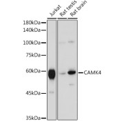 Western blot analysis of various lysates using CAMK4 Antibody at 1/1000 dilution. Secondary antibody: HRP-conjugated Goat anti-Rabbit IgG (H+L) at 1/10000 dilution. Lysates/proteins: 25 µg per lane. Blocking buffer: 3% nonfat dry milk in TBST. Exposure time: 10s.