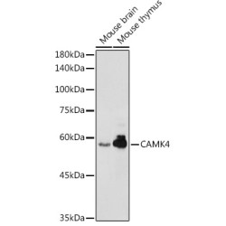 Calcium/calmodulin Dependent Protein Kinase IV (CAMK4) Antibody