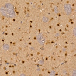 Calcium/calmodulin Dependent Protein Kinase IV (CAMK4) Antibody