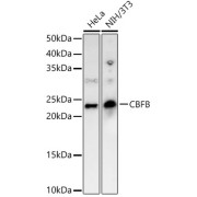 Western blot analysis of various lysates, using CBFB Antibody at 1/2000 dilution. Secondary antibody: HRP-conjugated Goat anti-Rabbit IgG (H+L) at 1/10000 dilution. Lysates/proteins: 25 µg per lane. Blocking buffer: 3% nonfat dry milk in TBST. Exposure time: 90s.