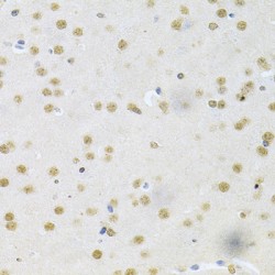 Core-Binding Factor Subunit Beta (CBFB) Antibody