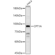Western blot analysis of lysates from HeLa cells using CPT1A Antibody at 1/2000 dilution. Secondary antibody: HRP-conjugated Goat anti-Rabbit IgG (H+L) at 1/10000 dilution. Lysates/proteins: 25 µg per lane. Blocking buffer: 3% nonfat dry milk in TBST. Exposure time: 30s.