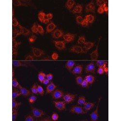 Carnitine Palmitoyltransferase 1A, Liver (CPT1A) Antibody