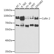Western blot analysis of various lysates using Cullin 2 Antibody at 1/1000 dilution. Secondary antibody: HRP-conjugated Goat anti-Rabbit IgG (H+L) at 1/10000 dilution. Lysates/proteins: 25 µg per lane. Blocking buffer: 3% nonfat dry milk in TBST. Exposure time: 90s.