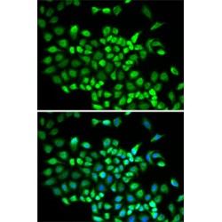 Cullin 2 (CUL2) Antibody