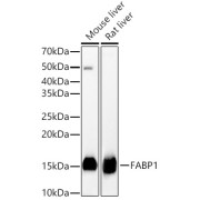 Western blot analysis of various lysates, using FABP1 Antibody at 1/5000 dilution. Secondary antibody: HRP-conjugated Goat anti-Rabbit IgG (H+L) at 1/10000 dilution. Lysates/proteins: 25 µg per lane. Blocking buffer: 3% nonfat dry milk in TBST. Exposure time: 30s.