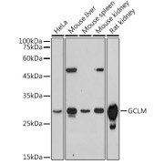 Western blot analysis of various lysates using GCLM Antibody at 1/1000 dilution. Secondary antibody: HRP-conjugated Goat anti-Rabbit IgG (H+L) at 1/10000 dilution. Lysates/proteins: 25 µg per lane. Blocking buffer: 3% nonfat dry milk in TBST. Exposure time: 180s.