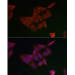 Glutamate Cysteine Ligase, Modifier Subunit (GCLM) Antibody