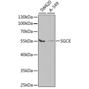 Western blot analysis of various lysates using SGCE Antibody at 1/1000 dilution. Secondary antibody: HRP-conjugated Goat anti-Rabbit IgG (H+L) at 1/10000 dilution. Lysates/proteins: 25 µg per lane. Blocking buffer: 3% nonfat dry milk in TBST. Exposure time: 90s.