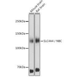 Electrogenic Sodium Bicarbonate Cotransporter 1 / NBC1 (SLC4A4) Antibody