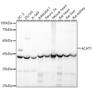 Western blot analysis of various lysates, using ACAT1 Antibody at 1/1000 dilution. Secondary antibody: HRP-conjugated Goat anti-Rabbit IgG (H+L) at 1/10000 dilution. Lysates/proteins: 25 µg per lane. Blocking buffer: 3% nonfat dry milk in TBST. Exposure time: 1s.