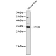 Western blot analysis of lysates from wild type (WT) and 293T cells transfected with C1QB using C1QB Antibody at 1/1000 dilution. Secondary antibody: HRP-conjugated Goat anti-Rabbit IgG (H+L) at 1/10000 dilution. Lysates/proteins: 25 µg per lane. Blocking buffer: 3% nonfat dry milk in TBST. Exposure time: 5s.