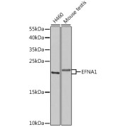 Western blot analysis of various lysates using EFNA1 Antibody at 1/1000 dilution. Secondary antibody: HRP-conjugated Goat anti-Rabbit IgG (H+L) at 1/10000 dilution. Lysates/proteins: 25 µg per lane. Blocking buffer: 3% nonfat dry milk in TBST. Exposure time: 30s.