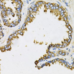 Ephrin A1 (EFNA1) Antibody