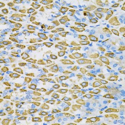 Ephrin A1 (EFNA1) Antibody