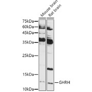 Western blot analysis of various lysates using GHRH Antibody at 1/1000 dilution. Secondary antibody: HRP-conjugated Goat anti-Rabbit IgG (H+L) at 1/10000 dilution. Lysates/proteins: 25 µg per lane. Blocking buffer: 3% nonfat dry milk in TBST. Exposure time: 180s.