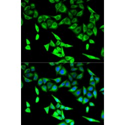 Trifunctional Enzyme Subunit Alpha, Mitochondrial (HADHA) Antibody