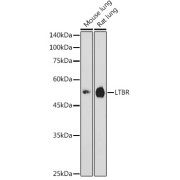 Western blot analysis of various lysates using LTBR Antibody at 1/1000 dilution. Secondary antibody: HRP-conjugated Goat anti-Rabbit IgG (H+L) at 1/10000 dilution. Lysates/proteins: 25 µg per lane. Blocking buffer: 3% nonfat dry milk in TBST. Exposure time: 180s.