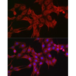 Lymphotoxin Beta Receptor (LTBR) Antibody