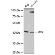 Western blot analysis of various lysates using MVK Antibody at 1/1000 dilution. Secondary antibody: HRP-conjugated Goat anti-Rabbit IgG (H+L) at 1/10000 dilution. Lysates/proteins: 25 µg per lane. Blocking buffer: 3% nonfat dry milk in TBST. Exposure time: 60s.