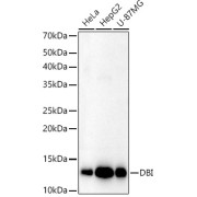 Western blot analysis of lysates from wild type (WT) and DBI knockout (KO) 293T cells, using [KO Validated] DBI Antibody at 1/1000 dilution. Secondary antibody: HRP-conjugated Goat anti-Rabbit IgG (H+L) at 1/10000 dilution. Lysates/proteins: 25 µg per lane. Blocking buffer: 3% nonfat dry milk in TBST. Exposure time: 1s.